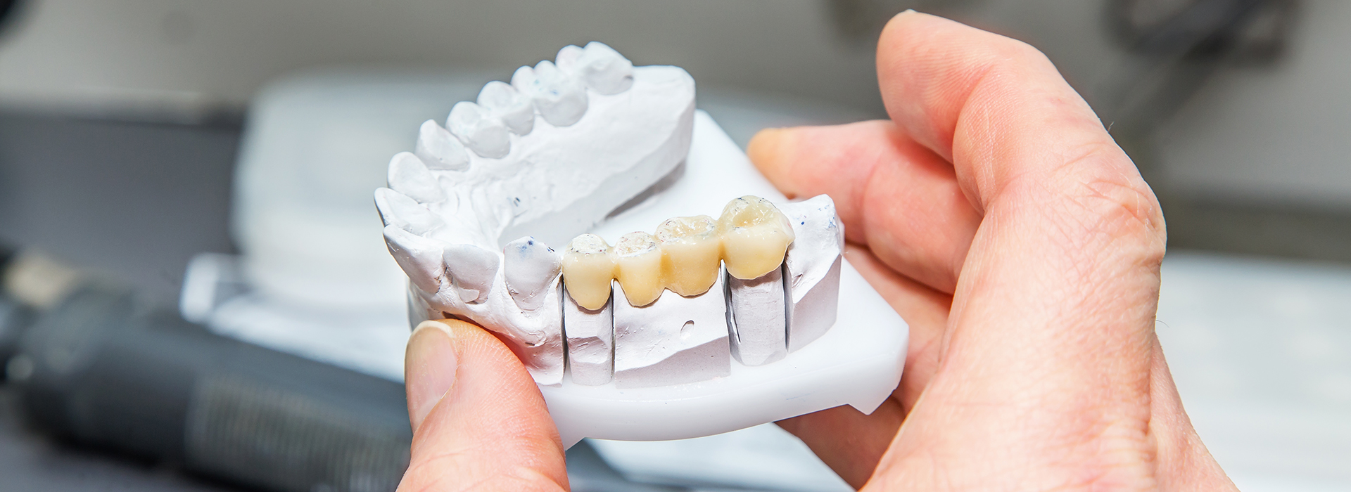 Advanced Dental Care of Towson | Teeth Whitening, Pediatric Dentistry and Dental Cleanings