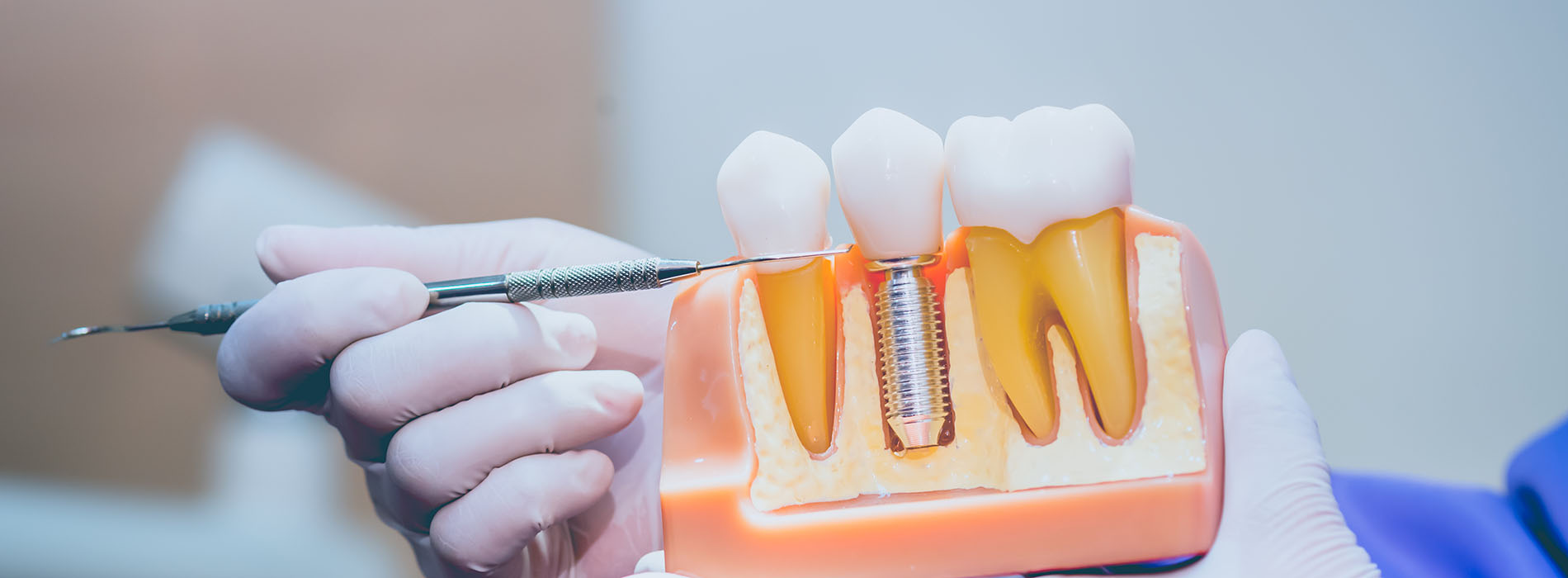 Advanced Dental Care of Towson | Emergency Treatment, Implant Dentistry and Dentures