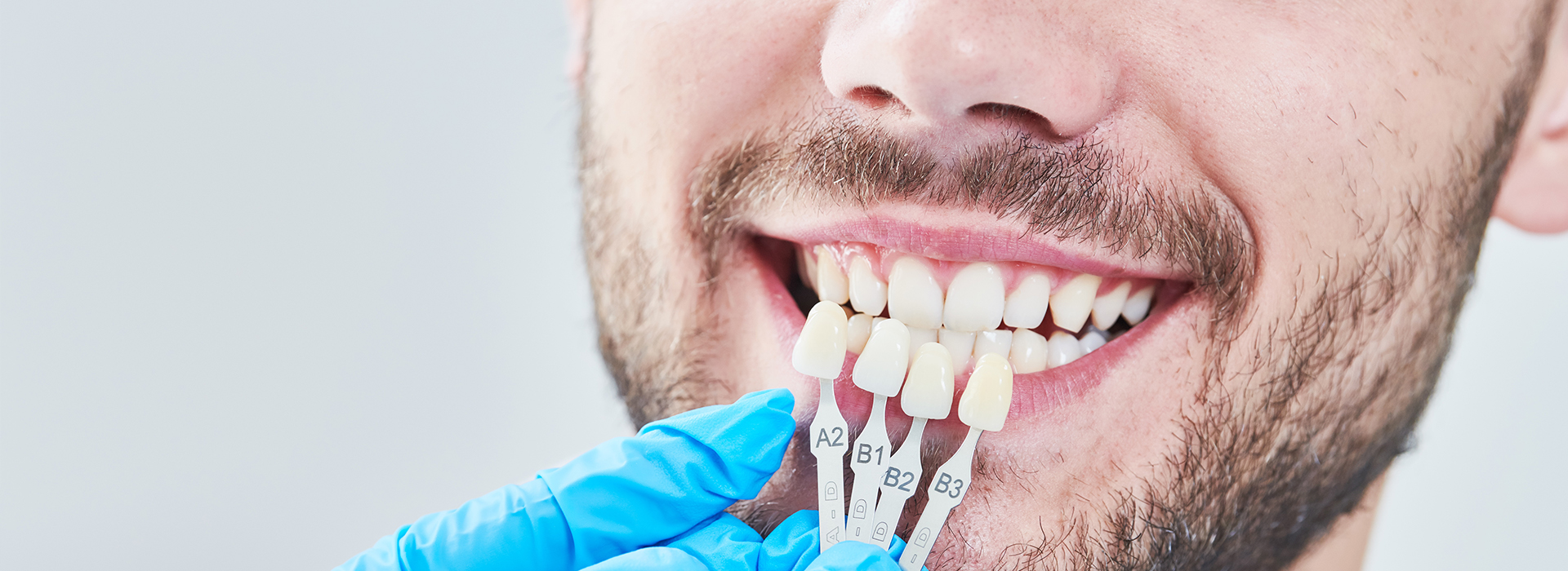 Advanced Dental Care of Towson | Preventative Program, Night Guards and Root Canals