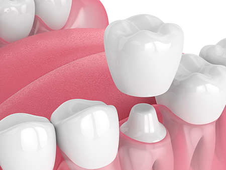 Advanced Dental Care of Towson