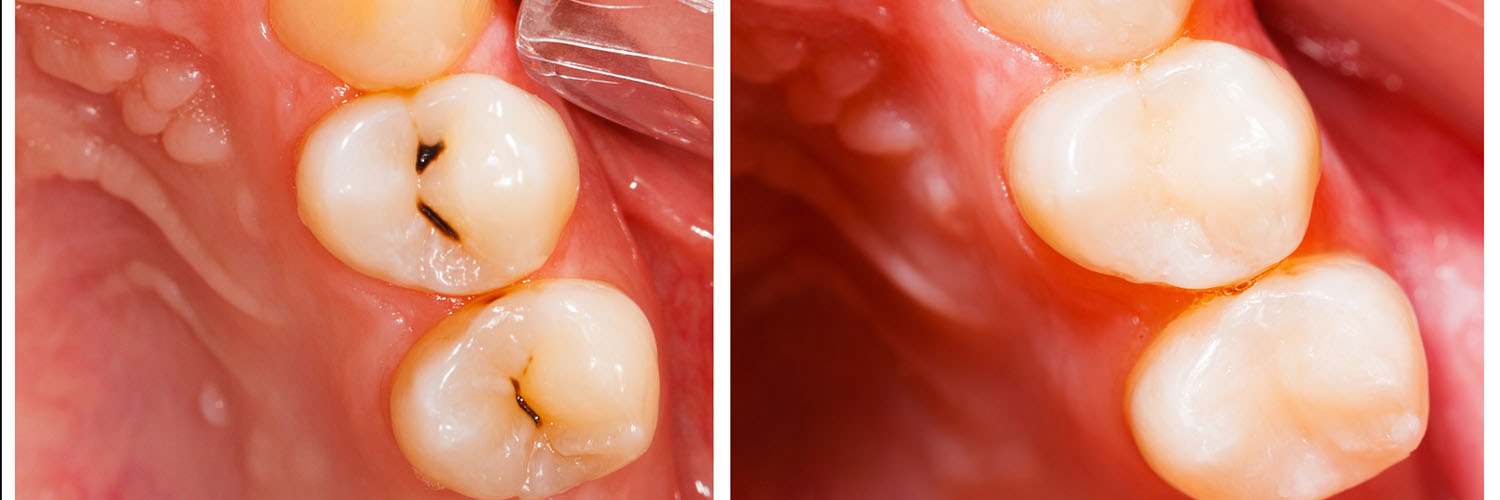 Advanced Dental Care of Towson