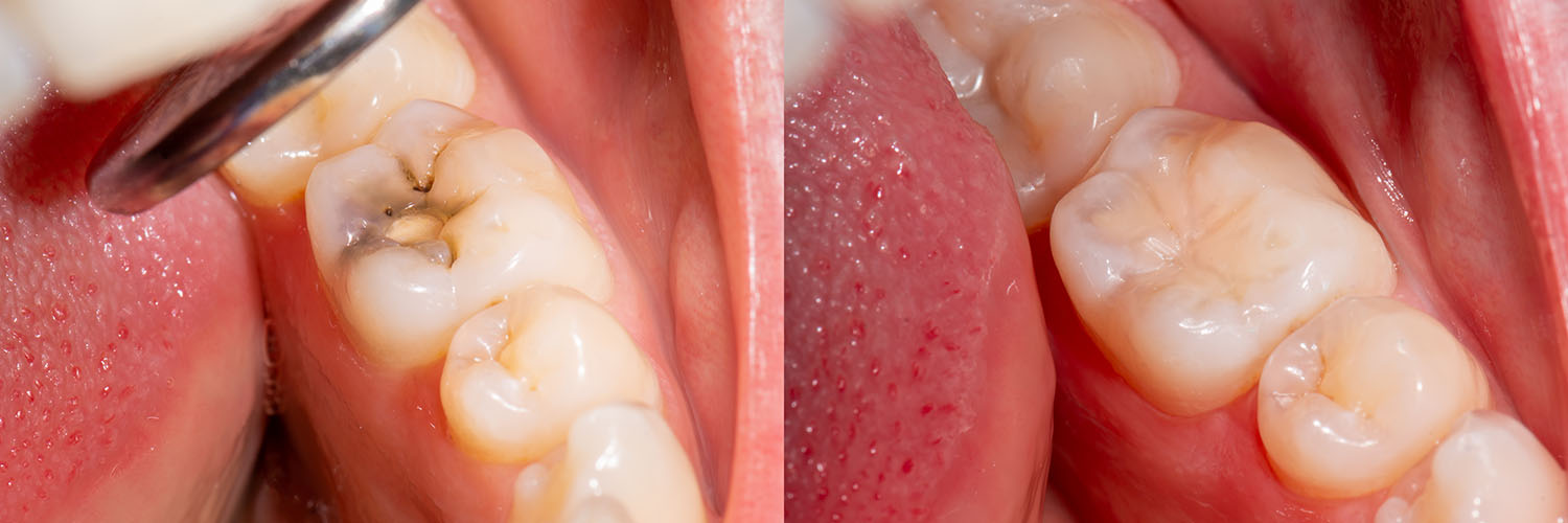 Advanced Dental Care of Towson