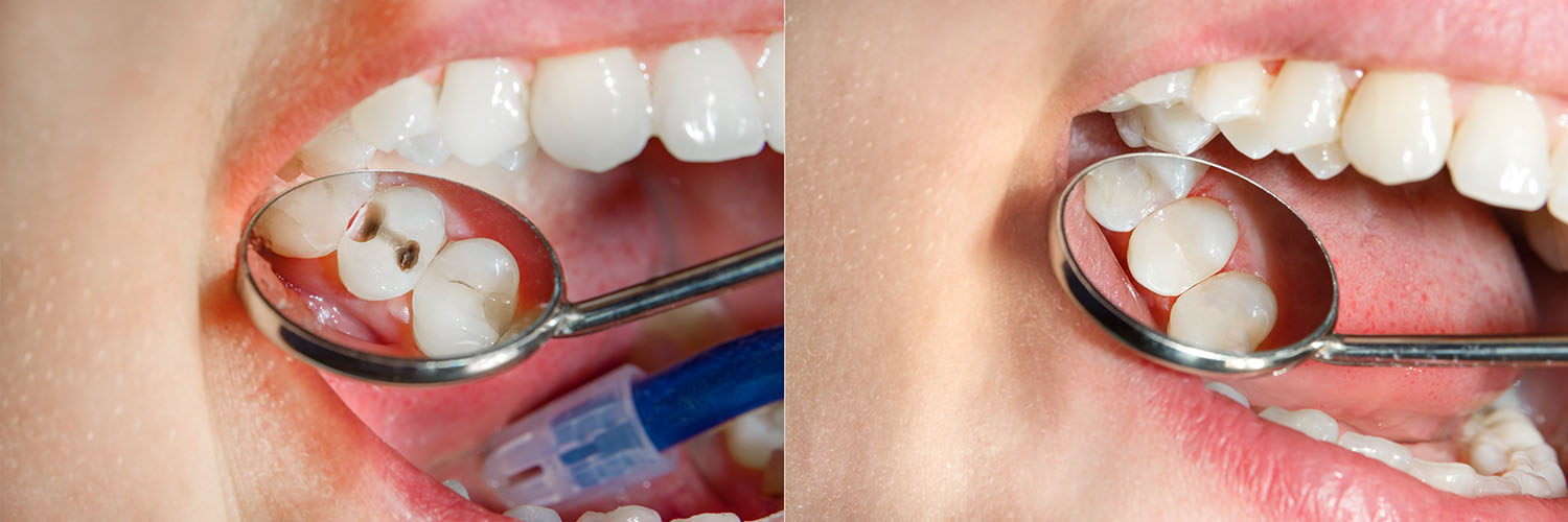 Advanced Dental Care of Towson